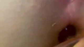 Upclose anal insertion