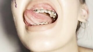 Look in my throat. Uvula show