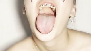 Look in my throat. Uvula show