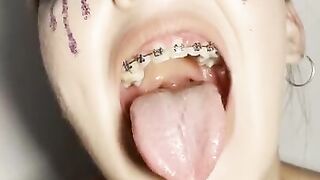 Look in my throat. Uvula show