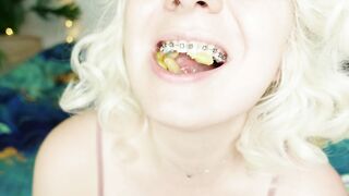 BRACES fetish: ASMR video of eating MUKBANG.