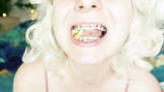 BRACES fetish: ASMR video of eating MUKBANG.