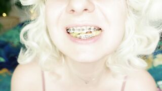 BRACES fetish: ASMR video of eating MUKBANG.