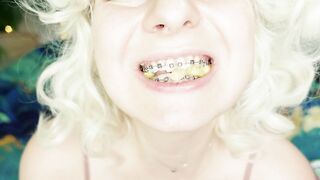 BRACES fetish: ASMR video of eating MUKBANG.